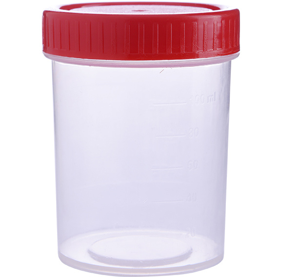 Sample Containers, Urine Culture Bottles